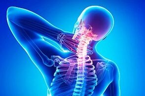bol u leđima kao simptom osteohondroze