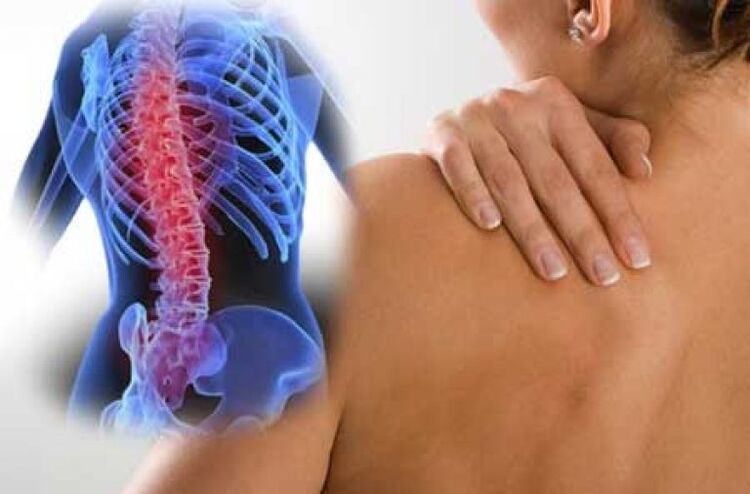 Tokom egzacerbacije osteohondroze torakalne kičme, javlja se dorsago bol