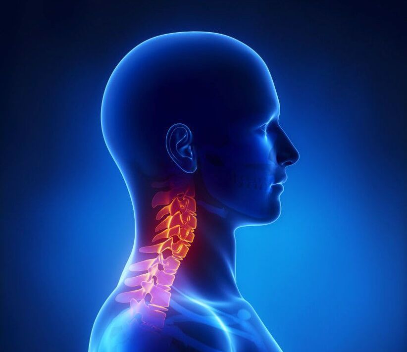 Cervikalna osteohondroza je patologija kralježnice, koje se možete riješiti kod kuće