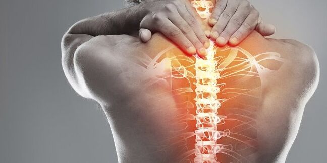 Medicinske opcije za terapiju cervikalne terapije cervikalne osteohondroze